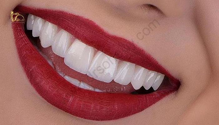 دکتر خوب برای کامپوزیت همدان